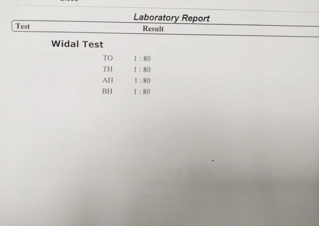 Widal Test Price in Bangladesh 2026 — রিপোর্ট, নরমাল রেঞ্জ ও সম্পূর্ণ গাইড 3 Widal Test রিপোর্ট বোঝার নিয়ম — TO, TH, AO, AH, BO, BH টাইটার ব্যাখ্যা