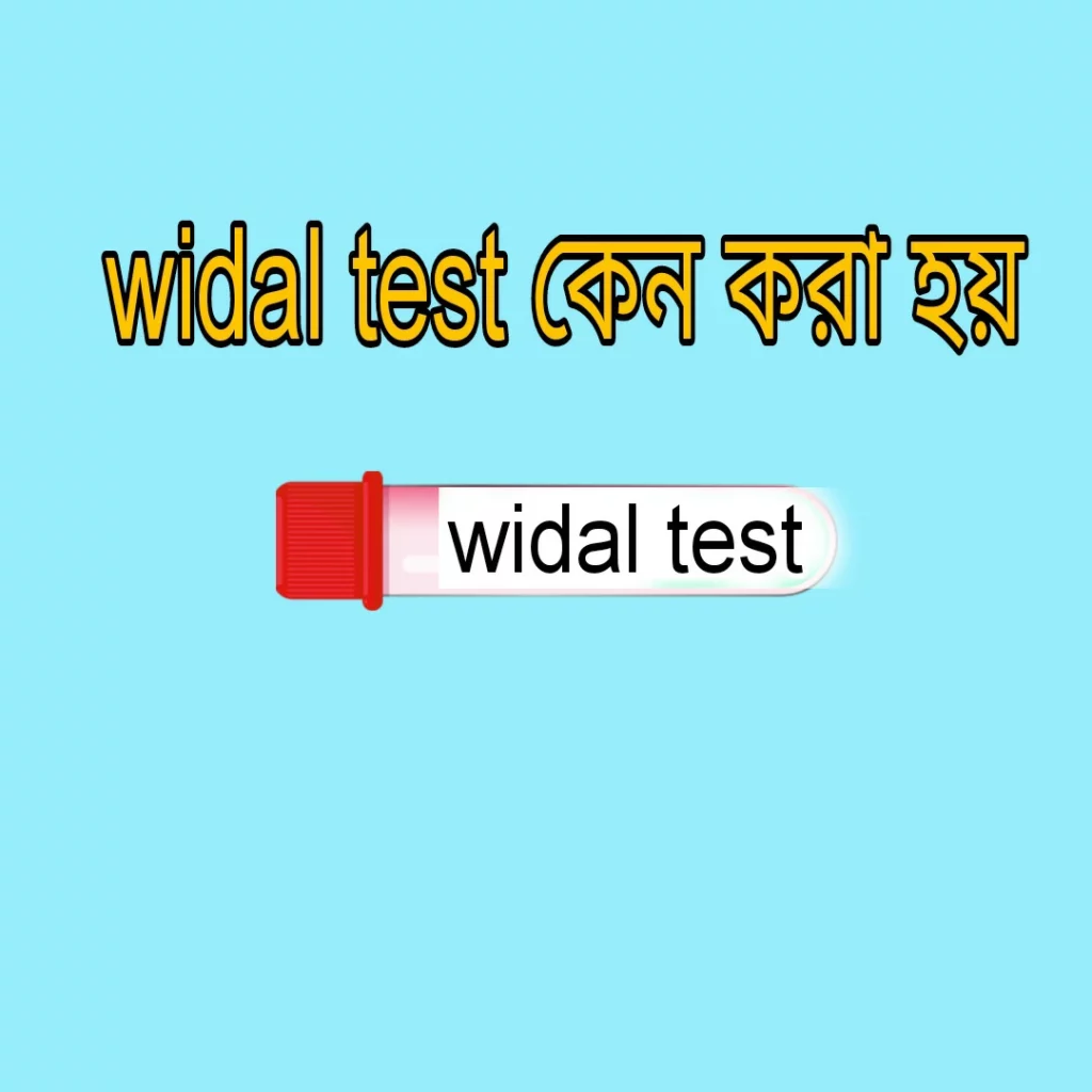 Widal Test Price in Bangladesh 2026 — রিপোর্ট, নরমাল রেঞ্জ ও সম্পূর্ণ গাইড 2 Widal Test প্রক্রিয়া — ল্যাবরেটরিতে রক্তের সিরাম থেকে অ্যান্টিবডি নির্ণয়