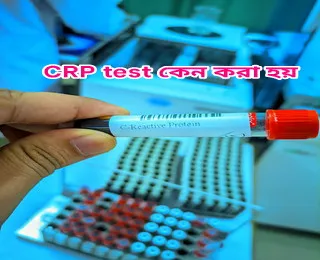 CRP Test কি? CRP Test কেন করা হয়? খরচ কত? CRP বেশি হলে কি হয় ...