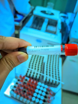 crp test price in bangladesh 2026 | CRP test কি? CRP test কেন করা হয়? CRP বেশি হলে কি হয়? 2 সিআরপি টেস্ট কত টাকা | crp test price