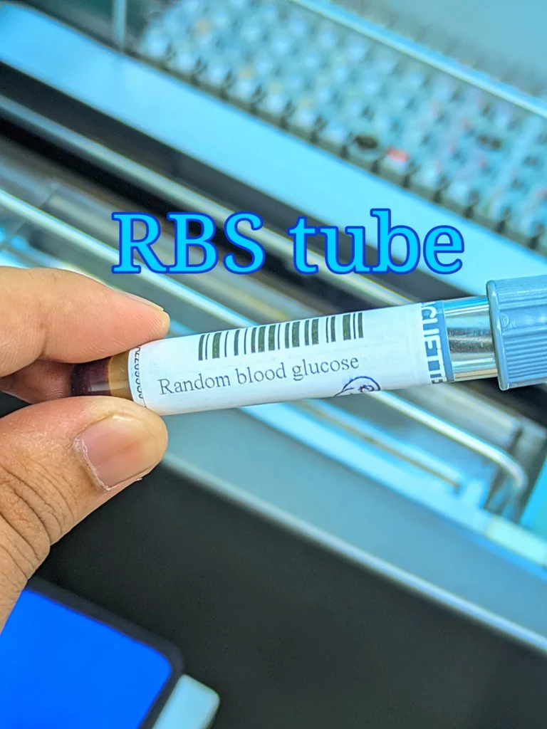 sodium fluoride grey tube rbs blood sugar test sample collection bangladesh lab