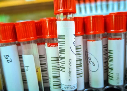 (সিরাম ইলেক্ট্রোলাইট) serum electrolytes test price in bangladesh 2026 – s electrolytes test bangla