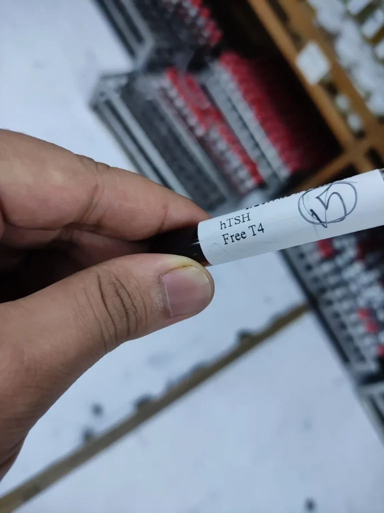 FT4 blood test red tube serum sample — thyroid hormone laboratory analysis Bangladesh