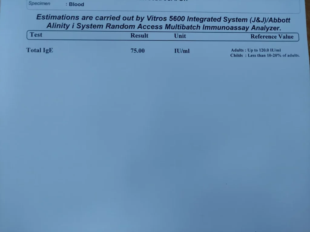 serum ige test report- normal level by age
