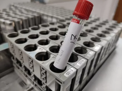 Uric acid test sample collection — red top vacutainer tube for serum analysis