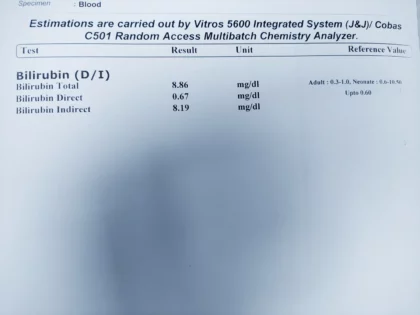 bilirubin test কেন করা হয়? জন্ডিস টেস্ট কত টাকা? জেনে নিন সব একসাথে। 4 বিলিরুবিন নরমাল রেঞ্জ