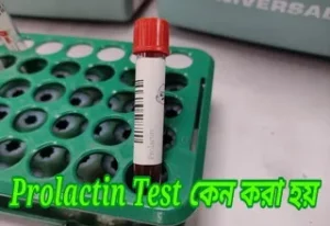 prolactin test কেন করা হয়