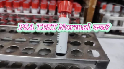 psa test normal