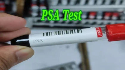 psa test কেন করা হয়