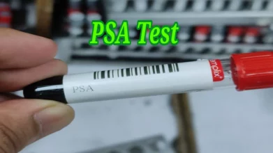 psa test কেন করা হয়? খরচ কত ? psa test details in bangla. 1 psa test কেন করা হয়