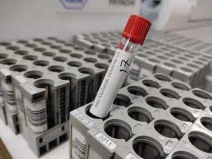 AMH test sample collection — সিরাম সংগ্রহের জন্য রেড টিউব ব্যবহার করা হয়