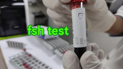 fsh test price in bangladesh
