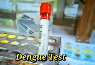 ns1 dengue test