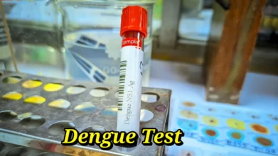 ns1 dengue test