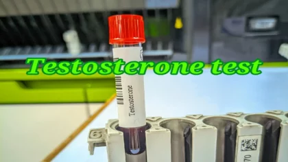 টেস্টোস্টেরন হরমোন টেস্ট খরচ বাংলাদেশ ? টেস্টোস্টেরন হরমোন কি ? টেস্টোস্টেরন পরীক্ষা কেন করা হয়? টেস্টোস্টেরন বৃদ্ধির উপায় কি? 1 টেস্টোস্টেরন হরমোন পরীক্ষা