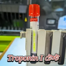 troponin i test কেন করা হয়? স্বাভাবিক মাত্রা কত , খরচ কত ? ট্রোপোনিন উচ্চ মাত্রার কারণ কি? 1 aRaFaTh94 20230531 185200 thambnail e1687933114563 troponin i test কেন করা হয়? স্বাভাবিক মাত্রা কত , খরচ কত ? ট্রোপোনিন উচ্চ মাত্রার কারণ কি?
