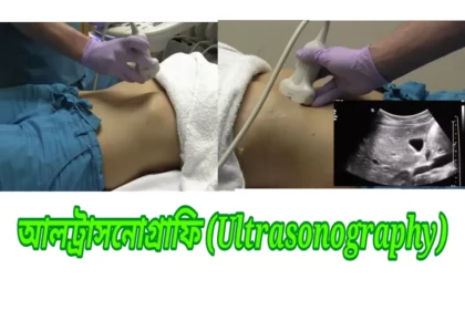 আল্ট্রাসনোগ্রাফি প্রস্তুতি — USG whole abdomen test preparation in Bangla