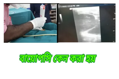 বায়োপসি টেস্ট কেন করা হয় — টিউমার, ক্যান্সার ও অস্বাভাবিক টিস্যু নির্ণয়ের জন্য histopathology পদ্ধতি