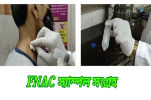 fnac test