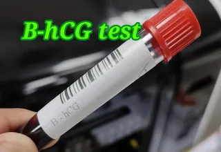 beta hcg test বা B-hCG কি এবং কেন করা হয়?নরমাল রেঞ্জ,খরচ, প্রিপারেশন, স্যাম্পল কালেকশন,রিপোর্ট ডেলিভারি জেনে নিন। | beta hcg test details in bangla. 1 beta hcg test