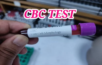 CBC Test কী? বাংলাদেশে খরচ কত ও রিপোর্ট বোঝার সম্পূর্ণ গাইড ২০২৬ 4 cbc test