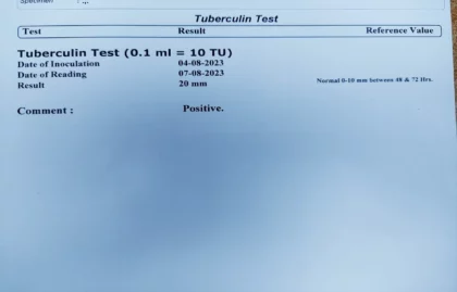 positive  MT টেস্ট রিপোর্ট