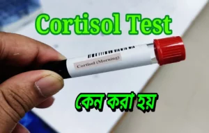 serum cortisol test কেন করা হয়া