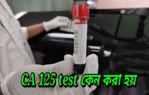 CA 125 test কেন করা হয়