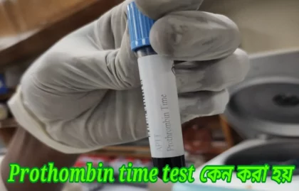 Prothombin time test কেন করা হয়
