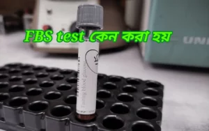 fasting blood sugar কেন করা হয়