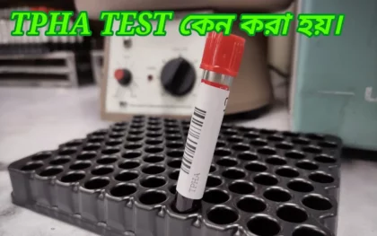 tpha test কি এবং কেন করা হয় ? Tpha টেস্ট সম্পর্কে সকল কিছু জেনে নিন? 1 tpha test কেন করা হয়