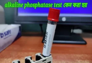 alkaline phosphatase test কেন করা হয়