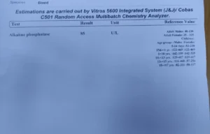 alkaline phosphatase test report