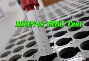 iron profile test কেন করা হয়