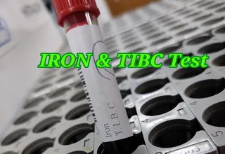 Iron profile test price in Bangladesh — আয়রন প্রোফাইল টেস্টের খরচ ও বিস্তারিত
