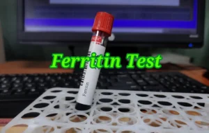 iron profile test  এর  Ferritin test.