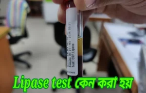 Lipase test কেন করা হয়