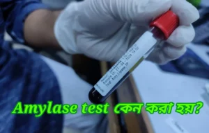 amylase test কেন করা হয়