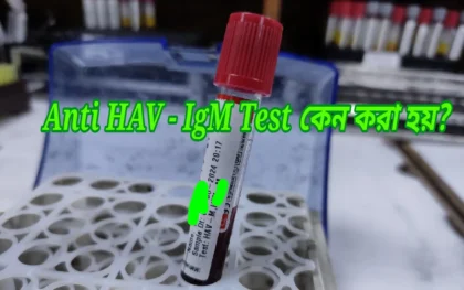 Anti HAV IgM test কেন করা হয়