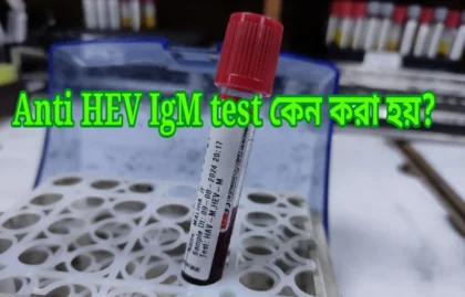 anti HEV IgM test কি এবং কেন করা হয়? anti HEV IgM test সম্পর্কে যাবতীয় তথ্য। 1 anti HEV IgM test কেন করা হয় ?
