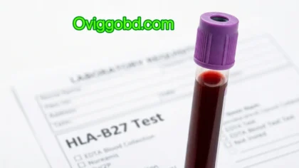 EDTA blood collection tube for HLA-B27 test — autoimmune disease diagnosis Bangladesh